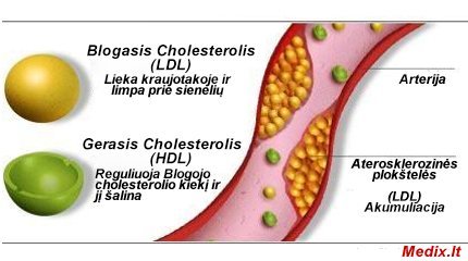 cholesterolio mazinimas